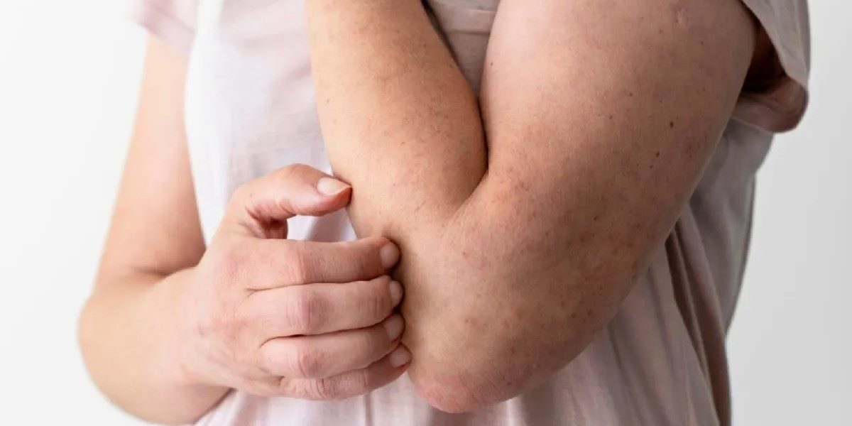 Saúde faz alerta sobre a hanseníase nesse Janeiro Roxo