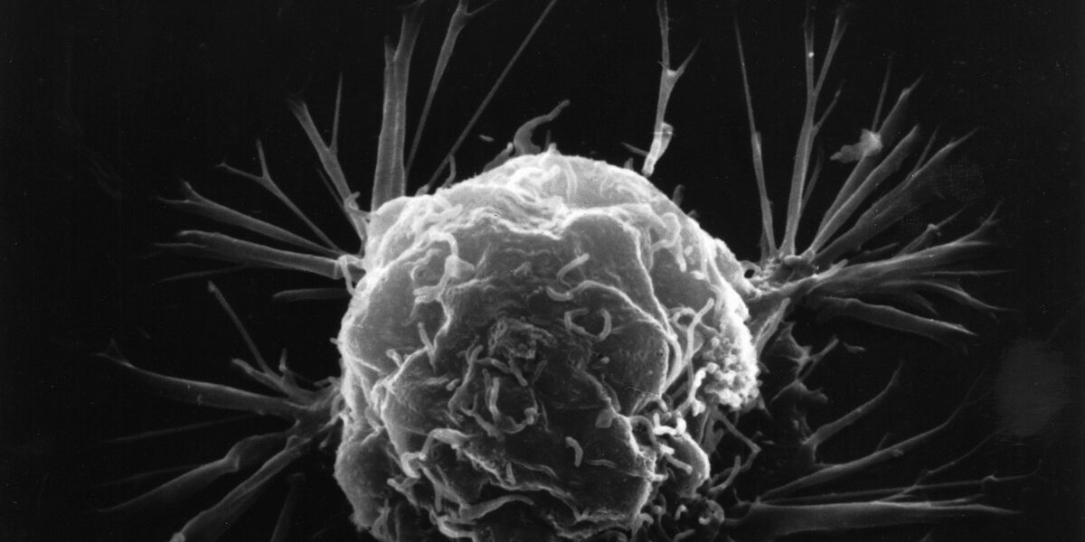 Uso de nanotecnologia em tratamentos contra o câncer é foco de estudo financiado pela Fapeg