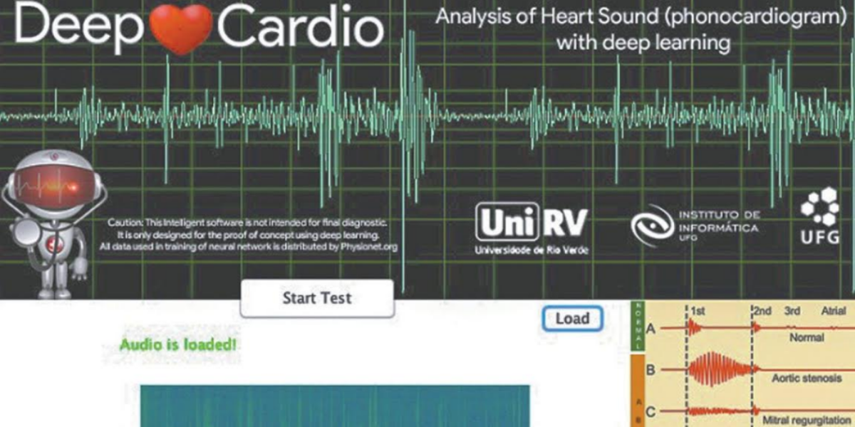 Aplicativo desenvolvido na UFG detecta anomalias cardíacas