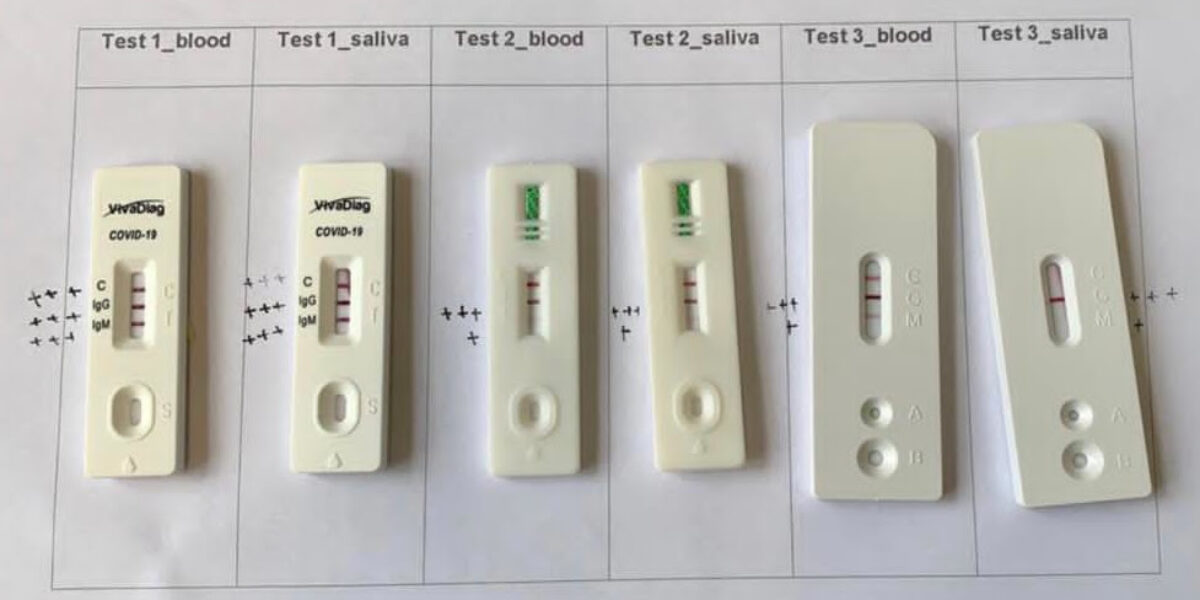 Pesquisadores avaliam desempenho dos testes rápidos de diagnóstico para Covid-19 pela saliva