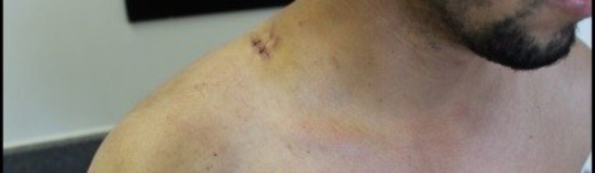 Apreendidos menores que tentaram matar motorista de aplicativo