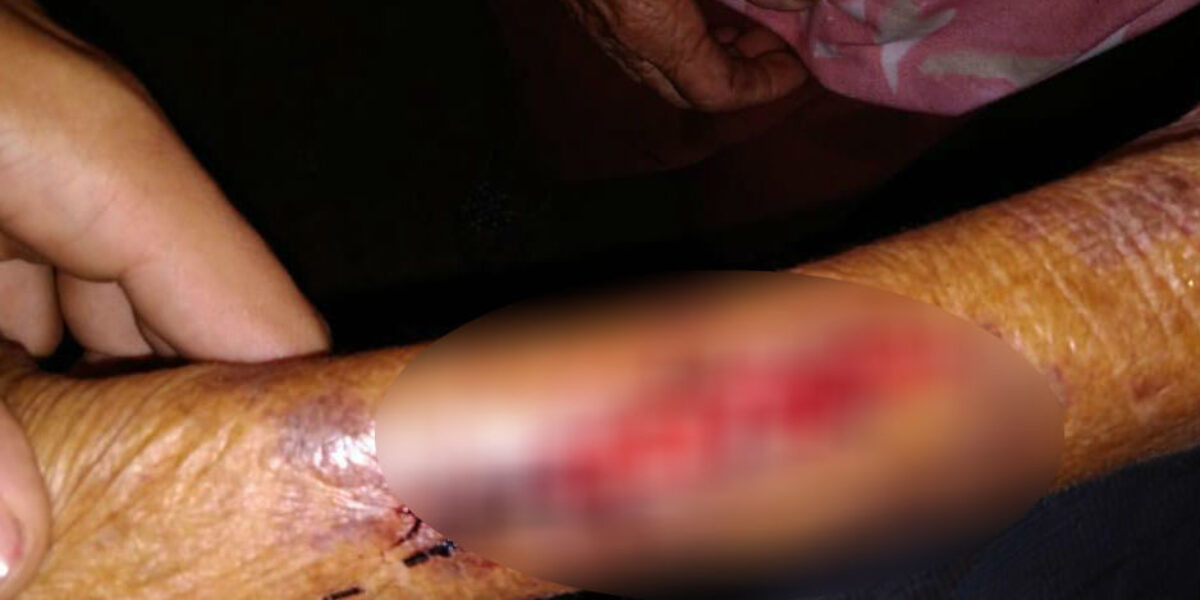 Mulher é presa em Morrinhos após agredir e ferir própria mãe