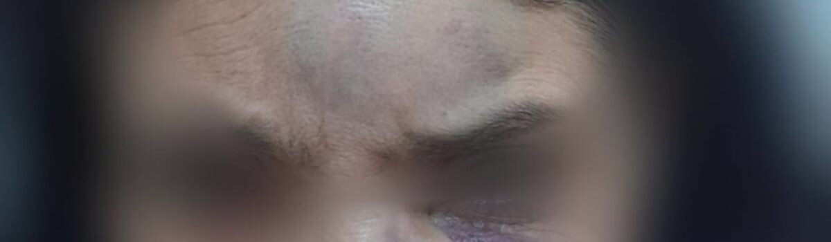 Homem é preso em Jaraguá após espancar namorada