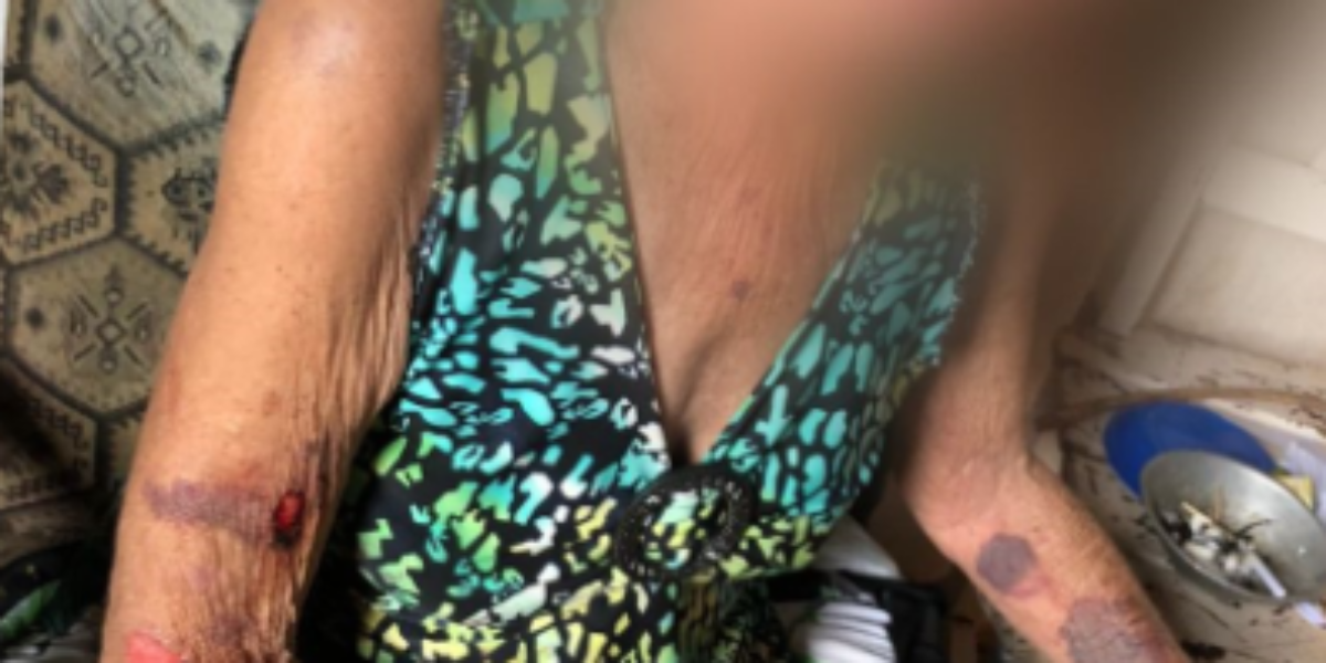 Filho é preso após espancar violentamente a mãe idosa, em Inhumas