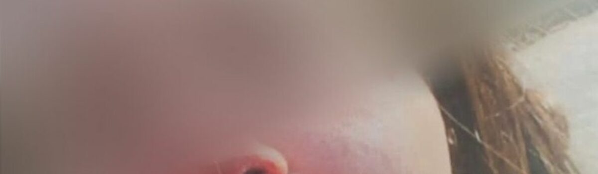 Ex é preso após espancar violentamente vítima em Aparecida de Goiânia