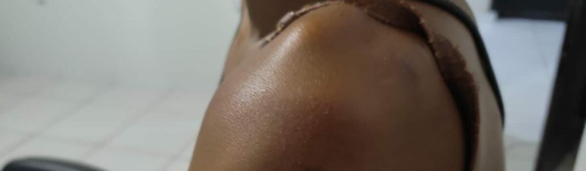 PCGO prende homem que espancou brutalmente companheira