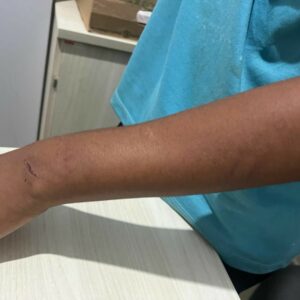 Polícia Civil efetua prisão por tortura, em Goianira