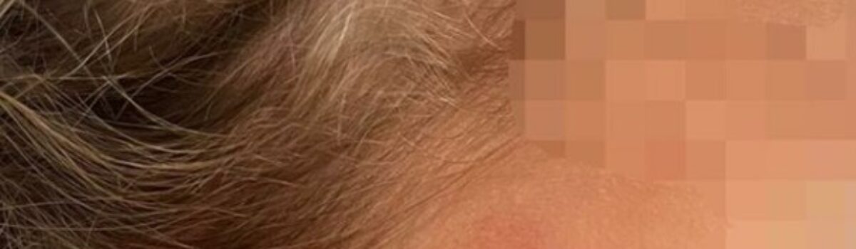 Mãe é presa em flagrante após agressões à filha de 4 anos em Planaltina