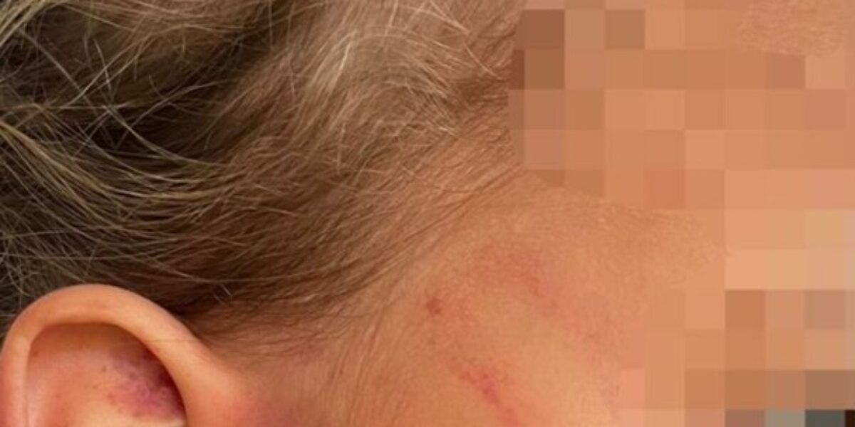 Mãe é presa em flagrante após agressões à filha de 4 anos em Planaltina