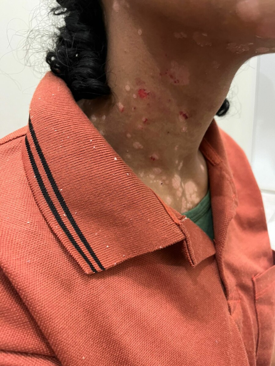 PCGO prende investigados por agressão a ex e filha