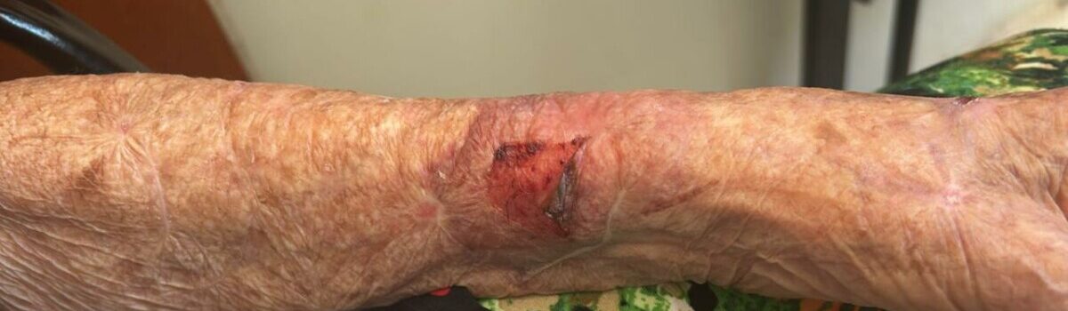 PCGO prende filha que agrediu mãe de 91 anos, em Anápolis