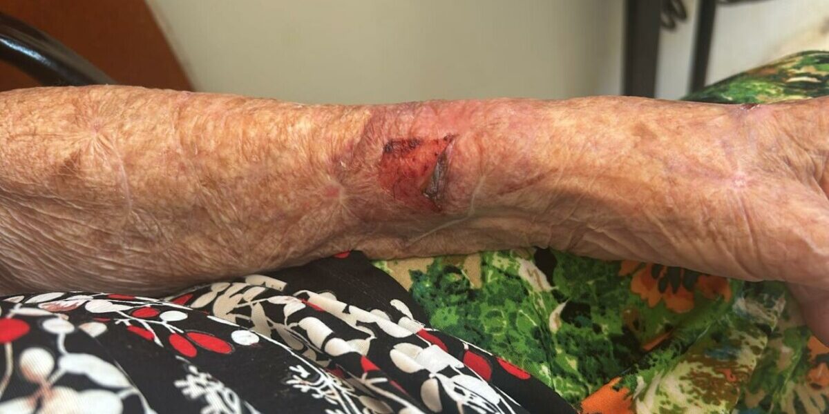 PCGO prende filha que agrediu mãe de 91 anos, em Anápolis