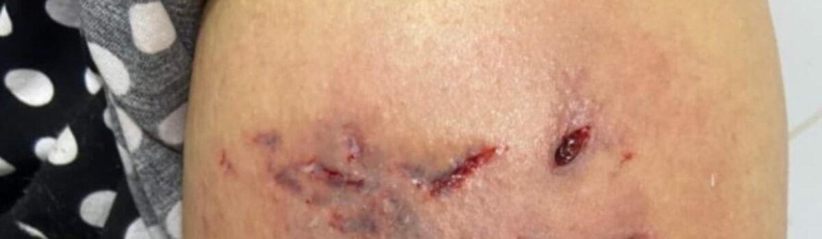 Três pessoas são presas em Itaberaí após Pitbull lesionar vítima, que não recebeu socorro