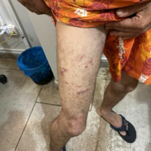 ‘TALIÃO’: PCGO prende dupla em flagrante por torturar vítima após suposto furto de ferramentas