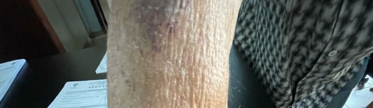 PC prende filho que agrediu o pai, em Anápolis, em disputa por herança