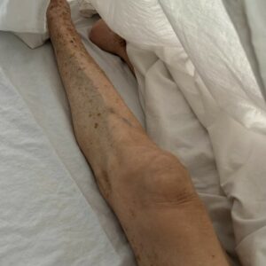 PCGO prende advogado pela segunda vez por crimes de maus-tratos contra a própria mãe idosa