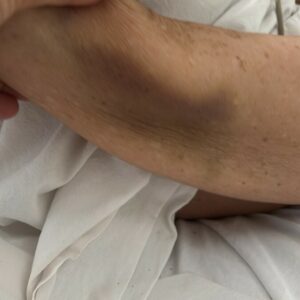 PCGO prende advogado pela segunda vez por crimes de maus-tratos contra a própria mãe idosa