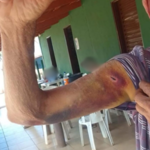 PCGO prende mulher por maus tratos e cárcere privado contra marido idoso e filho com necessidades especiais