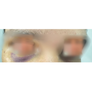 PCGO prende homem em flagrante por tráfico de drogas e por manter vítima em cárcere privado há aproximadamente um ano