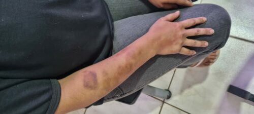 PCGO prende investigado por violência doméstica durante tentativa de fuga em Rio Verde