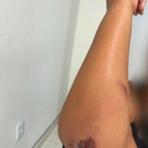 PCGO prende homem que arrombou portão da casa da companheira, a agrediu e ameaçou de morte