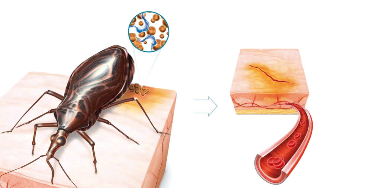 SES alerta para gravidade e importância de exames contra doença de Chagas