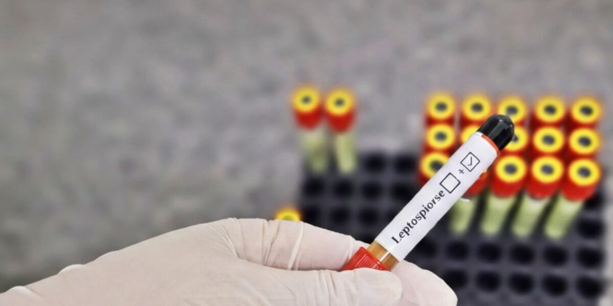 HDT alerta para cuidados essenciais contra a leptospirose no período chuvoso
