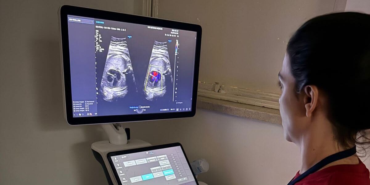 Hospital Estadual da Mulher faz mutirão de ecocardiograma fetal e atende 76 gestantes