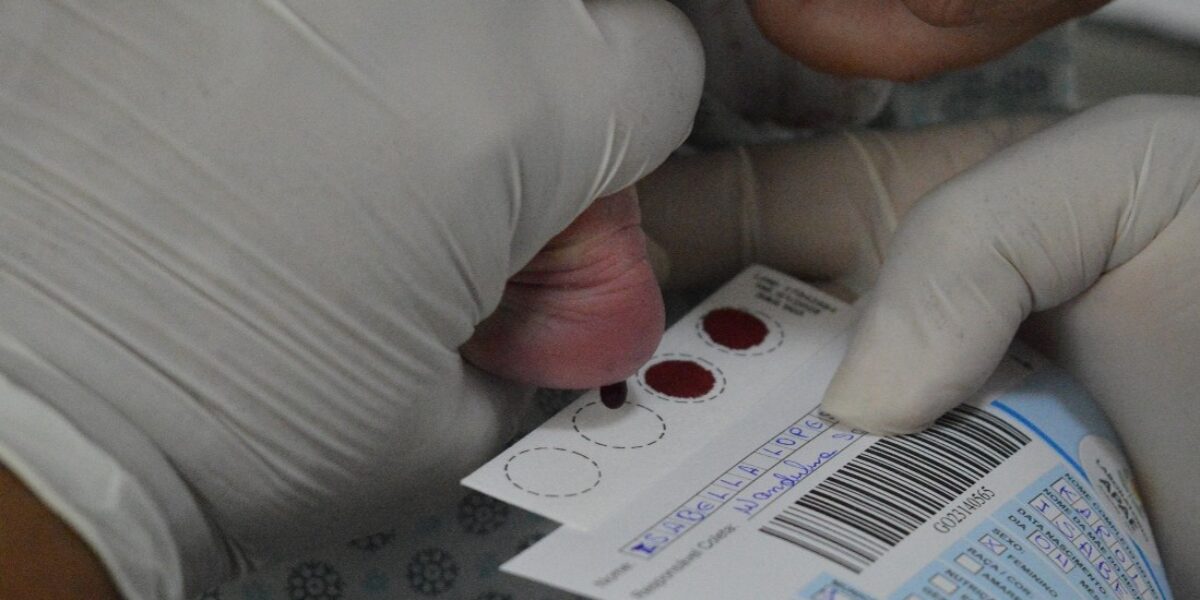 HEF reforça importância do Teste do Pezinho para diagnóstico precoce de doenças em recém-nascidos