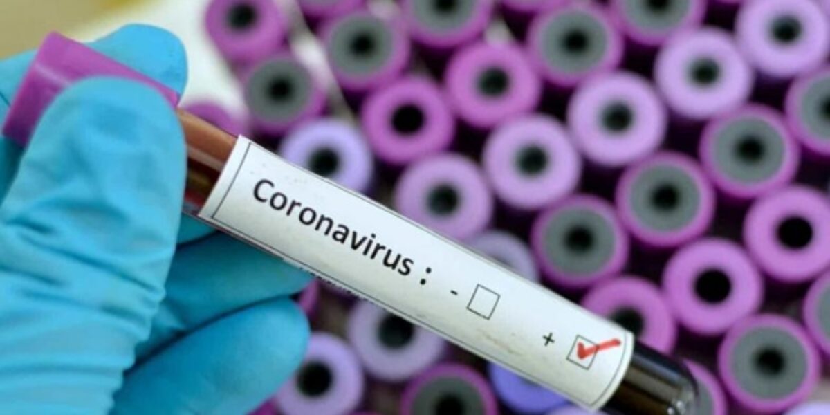 Goiás tem 56 casos confirmados de coronavírus
