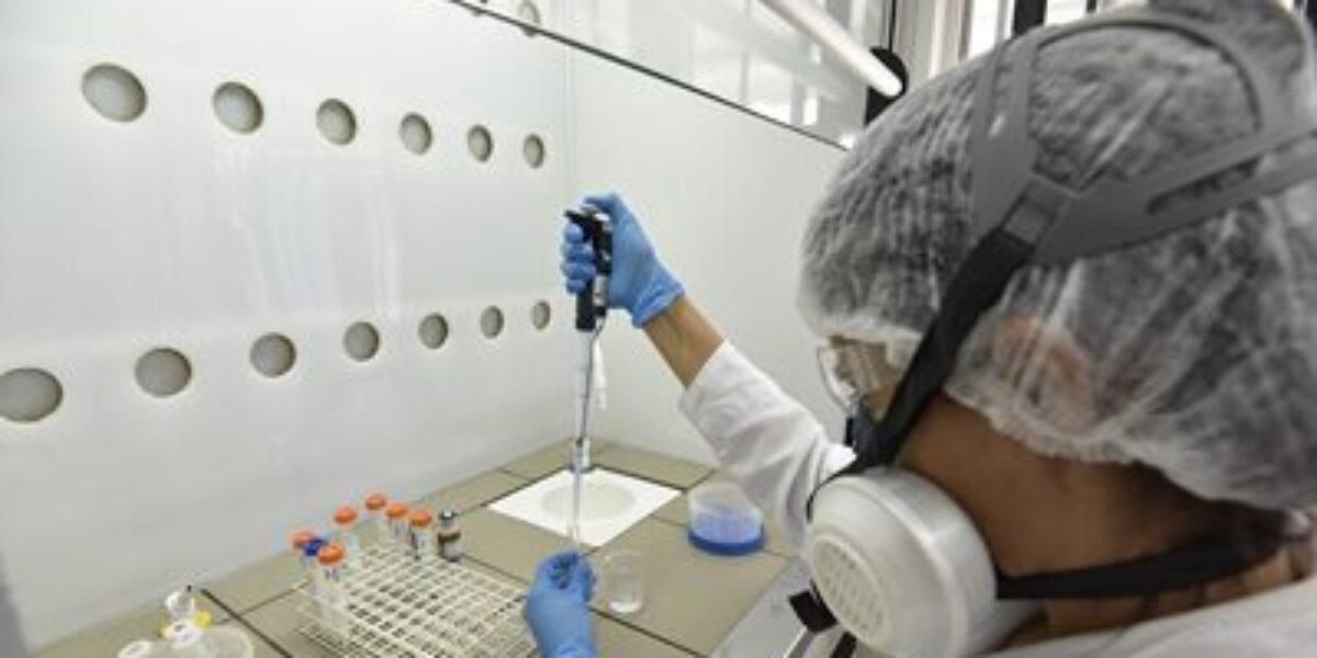 Lacen volta a operar exames de Covid-19 com capacidade máxima